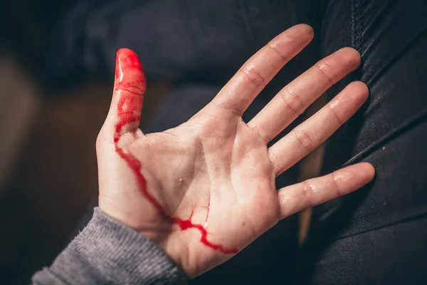 bleeding from cut of finger