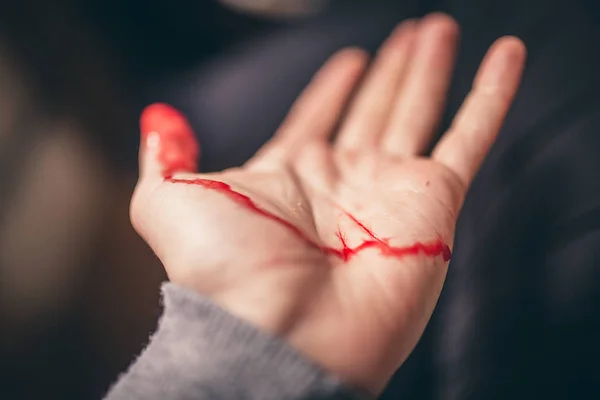 Bloeden uit knippen van de vinger — Stockfoto