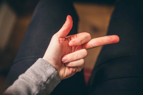 Blutungen aus abgetrenntem Finger — Stockfoto