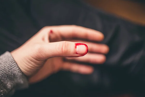 Blödning från snittet av finger — Stockfoto