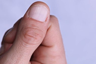 Adam ellerini yakın çekim, Manikür, kaba cilt bakım kavramı Makinası