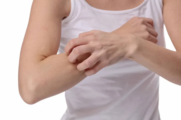 Mujer Arañando una comezón sobre fondo blanco. Piel sensible, Reacción alérgica, Irritación — Foto de Stock