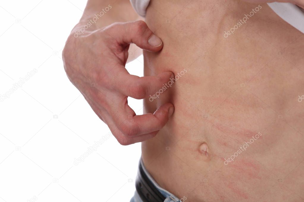 Man Scratching an itch on white background . Sensitive Skin, Allergic Reaction, Irritation