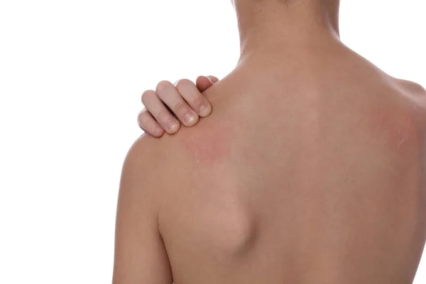 Niño Arañando una picazón aislada sobre fondo blanco. Piel sensible, Reacción alérgica, Irritación — Foto de Stock