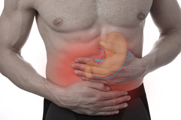 Man Stomach Pain Digestive System Problems — Stock Photo, Image