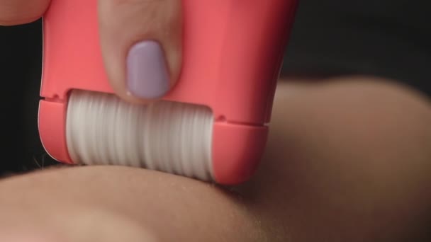 A mulher jovem faz a remoção do cabelo com um epilator elétrico. Close-up — Vídeo de Stock