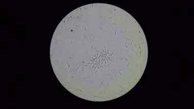 Trypanosoma cruzi fullhd, parlak dosyalanmış mikroskop görünüm