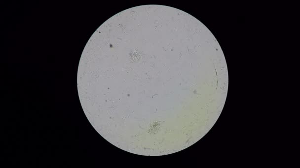 Trypanosoma cruzi full HD, vue de microscope classée lumineuse 