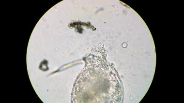 Rotifer 'ın cesedi bakteri kümesi tarafından çürütülüyor.