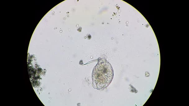 Rotifer dead body being decomposed by bacteria cluster — 비디오