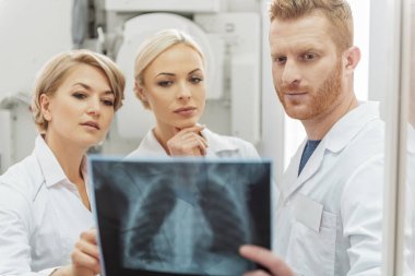 X-ışını fotoğrafa bakarak baktılar doktorlar