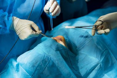 Ameliyathane meşgul tıbbi işçi