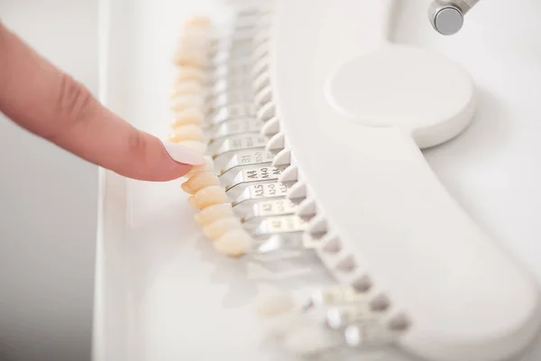Стоматолог демонстрирует типодонт в номере — стоковое фото