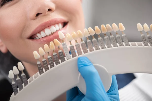Implante dental que encierra a la boca femenina feliz —  Fotos de Stock