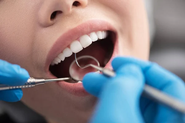 Dentista examinando la boca del cliente —  Fotos de Stock