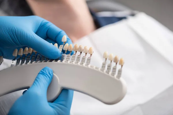 Manos estomatólogas manteniendo coronas dentales — Foto de Stock
