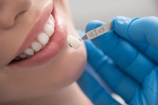 Korony dentystyczne sytuując w pobliżu ujścia szczęśliwą kobietą — Zdjęcie stockowe