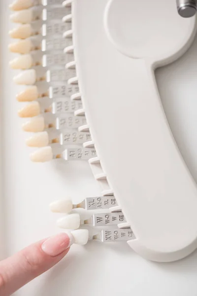 Odontologist demonstrating typodont in dental room — Stock Photo, Image