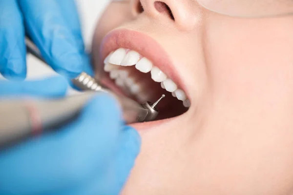 Odontólogo curando dientes de mujer —  Fotos de Stock