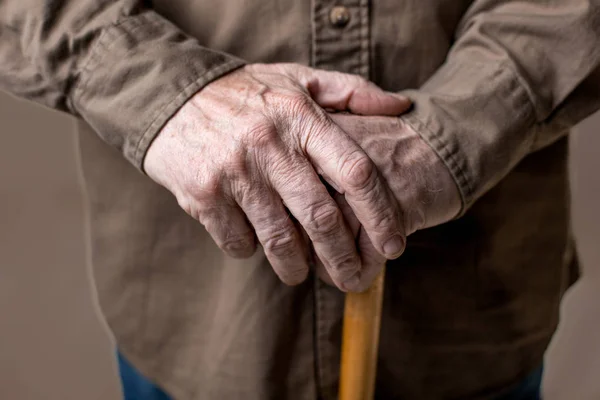 Old arms of disabled senior — Stock Photo, Image