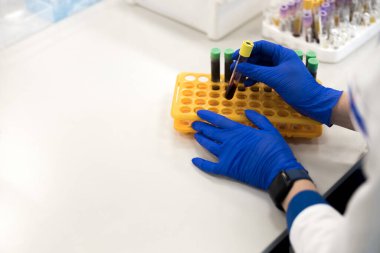 Laboratuvarda kan testi yapan kadın araştırmacı.