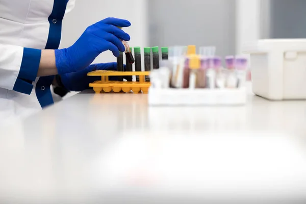 Científica tomando tubo de análisis de sangre para investigación de laboratorio — Foto de Stock