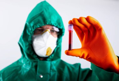 Koruyucu elbiseli bir adam, elinde kan örneğiyle test tüpünü dikkatlice tutuyor.