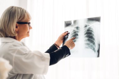 Kıdemli kadın doktor steteskoplu üniforma giyiyor. Röntgen fotoğrafına bakıyor. Sağlık ve ilaç.
