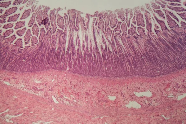 Fotografía del microscopio de una sección del intestino grueso con inflamación (colitis) ). — Foto de Stock