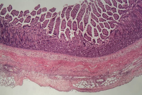 Fotografía del microscopio de una sección del intestino grueso con inflamación (colitis) ). — Foto de Stock