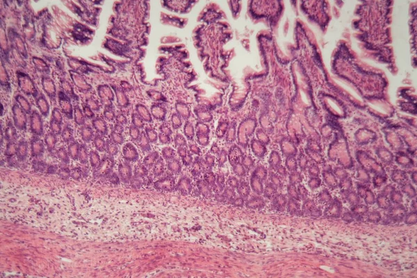 Microscópio foto de uma seção do intestino grosso com inflamação (colite ). — Fotografia de Stock