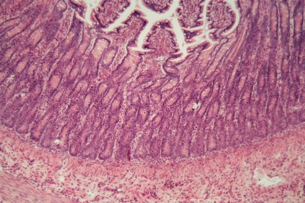 Microscópio foto de uma seção do intestino grosso com inflamação (colite ). — Fotografia de Stock