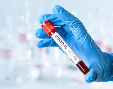 Tehlikeli koronavirüs enfeksiyonu salgını. COVID-19 testi için kan örneğiyle test tüpü.