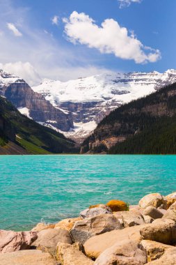 Louise Gölü Banff Ulusal Parkı, Alberta, Kanada