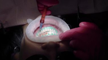 Diş hekimi doktor kadın hasta için diş beyazlatma yapıyor