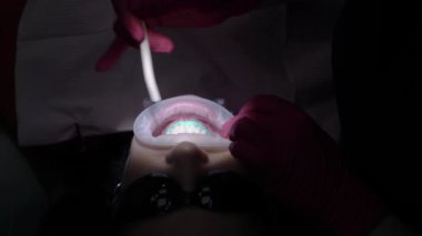 Diş hekimi doktor kadın hasta için diş beyazlatma yapıyor