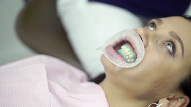 Palet ile diş beyazlatma kontrol