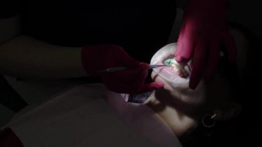 Sıvı cofferdam kaldırma