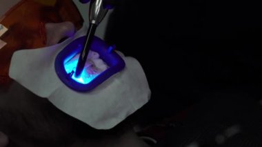 Uv lambası ile hasta için diş beyazlatma diş hekimi