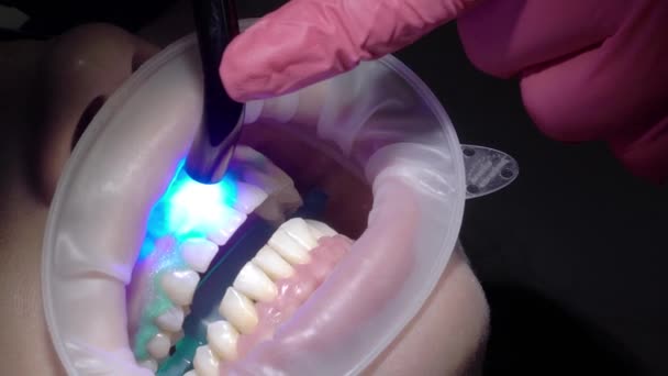 Lekarz dentysta robi dla kobiety pacjenta do wybielania zębów — Wideo stockowe
