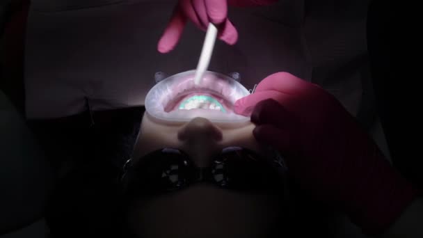 Lekarz dentysta robi dla kobiety pacjenta do wybielania zębów — Wideo stockowe