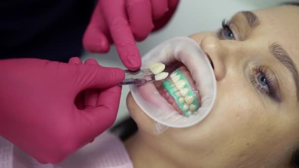 Kontrollera tandblekning med pallete — Stockvideo