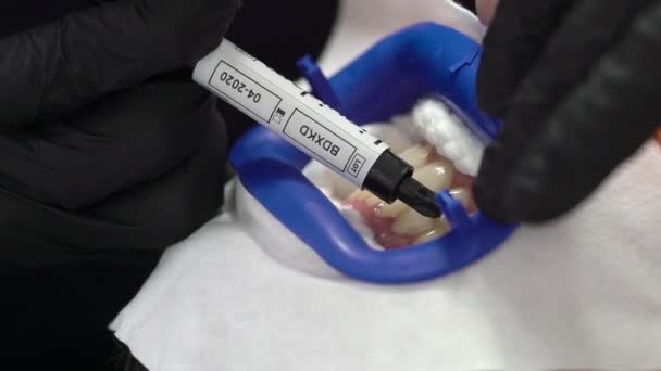 Dentista blanqueamiento de dientes para el paciente — Vídeo de stock