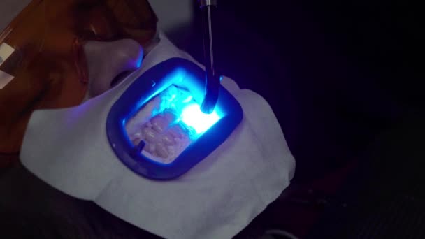Dentista blanqueamiento de dientes para el paciente con lámpara ultravioleta — Vídeos de Stock
