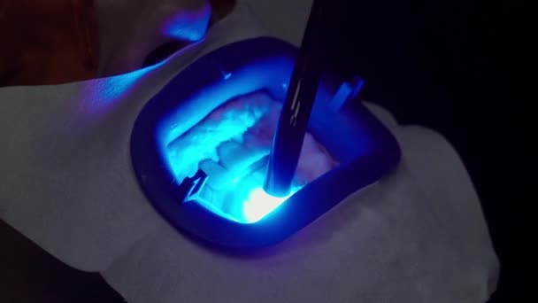 Dentiste blanchiment des dents pour le patient avec lampe UV — Video