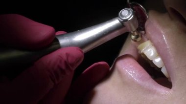 Diş hekimi diş hasta için temizlik yapma