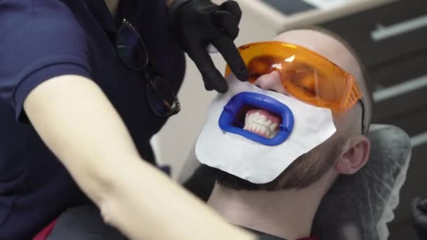 Dentist albire dinti pentru pacient — Videoclip de stoc