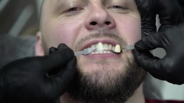 Tandläkare tandblekning tänderna för patienten — Stockvideo
