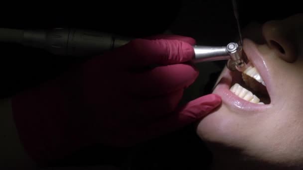 치과 환자에 대 한 청소 치아 만들기 — 비디오