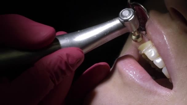 Οδοντίατρος κάνει δόντι καθαρισμός για ασθενή — Αρχείο Βίντεο